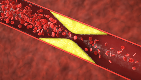 5 Cholesterol Myths and what to eat instead
