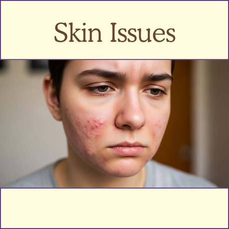 A person with visible acne on their face appears concerned under the heading "Skin Issues.
